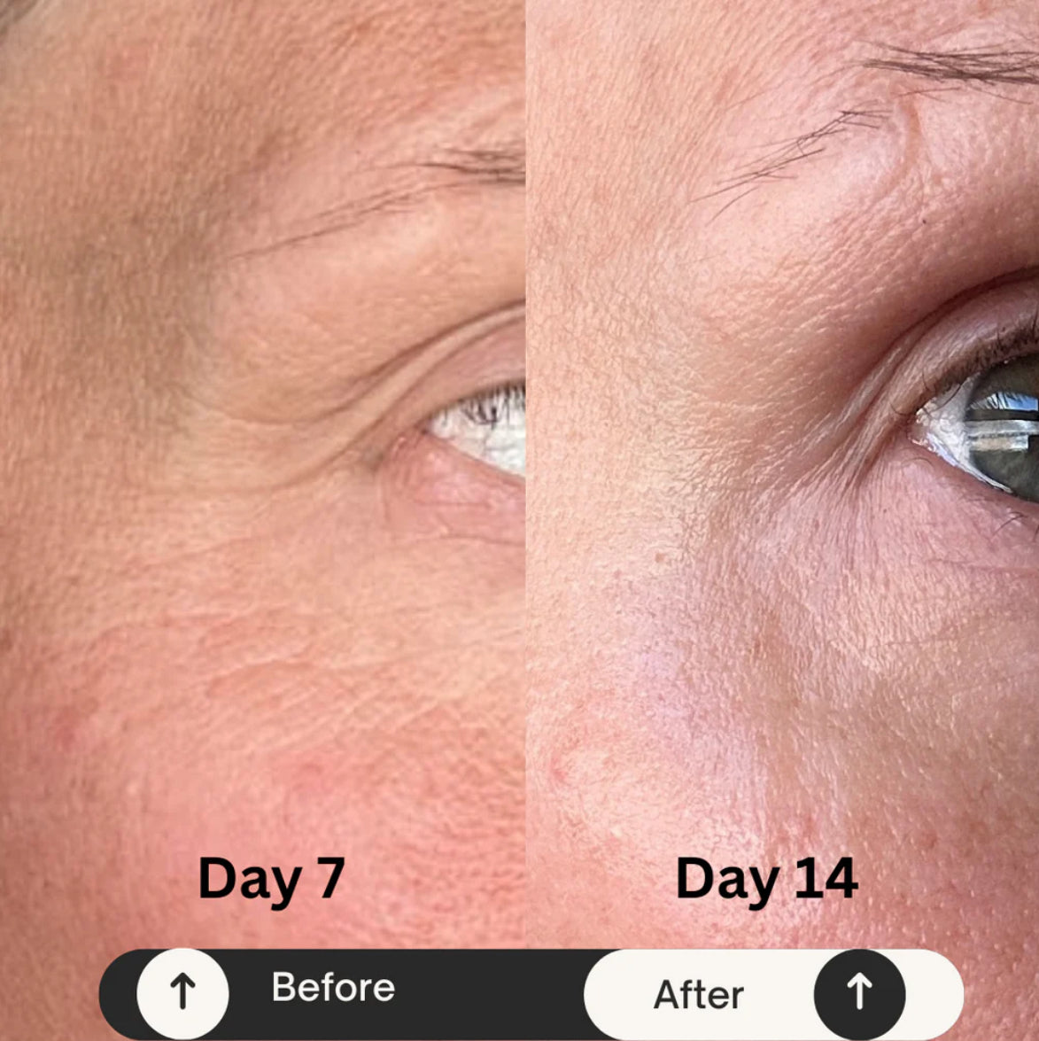 3x Advanced Peptide Wrinkle Combat Cream + Moisturiser